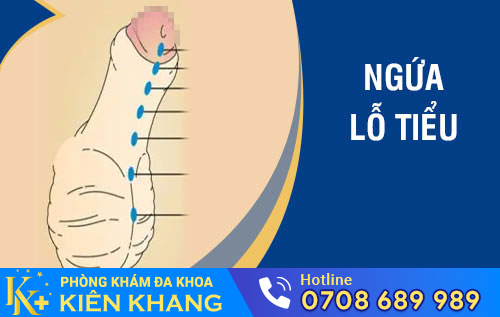 Ngứa lỗ tiểu