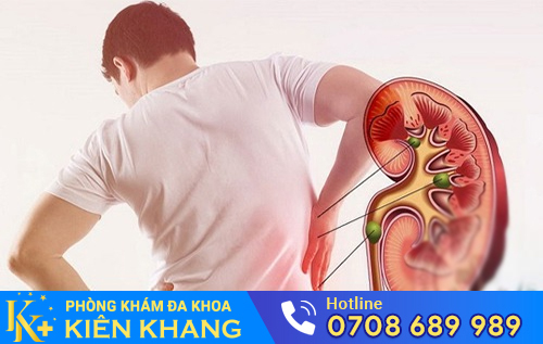 Hậu quả từ bệnh viêm đường tiểu là nguy cơ gây suy thận