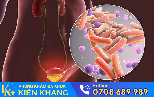 Nguyên nhân gây viêm đường tiểu ở nam giới