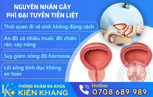 nguyen-nhan-phi-dai-tuyen-tien-liet.jpg