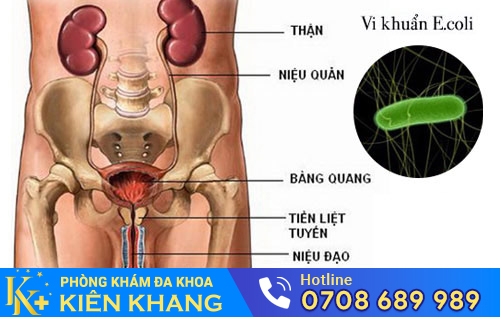 Các bệnh về đường tiết niệu, tuyến tiền liệt và niệu đạo có thể gây tiểu ra máu