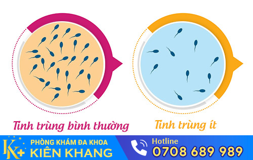 Tinh trùng ít