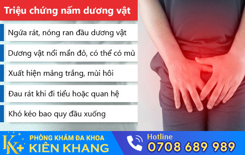 Triệu chứng nấm dương vật ở nam giới