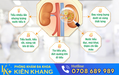 Triệu chứng viêm đường tiểu