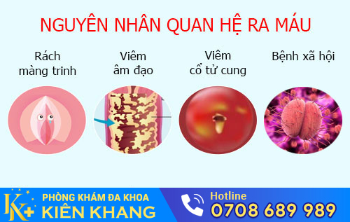 Nguyên nhân quan hệ ra máu