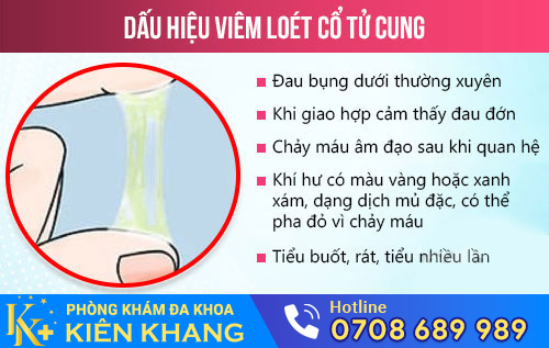 Viêm loét cổ tử cung