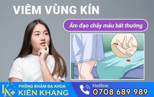 Viêm vùng kín