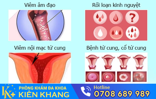 Biểu hiện của một số bệnh phụ khoa thường gặp