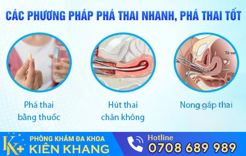 Các phương pháp phá thai nhanh, phá thai tốt hiện nay