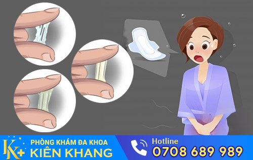 hiện tượng khí hư bất thường