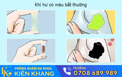 Khí hư có màu - dấu hiệu cảnh báo một số bệnh phụ khoa