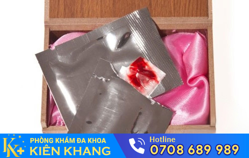Hình ảnh màng trinh giả