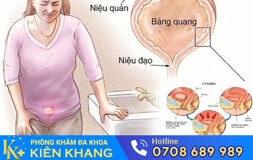 Nguyên nhân tiểu đêm nhiều lần