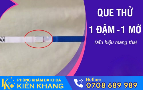 Que thử thai 1 vạch đậm 1 vạch mờ