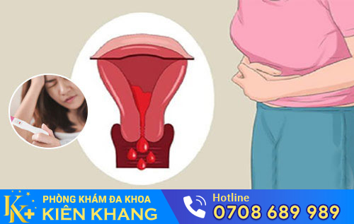 rong kinh