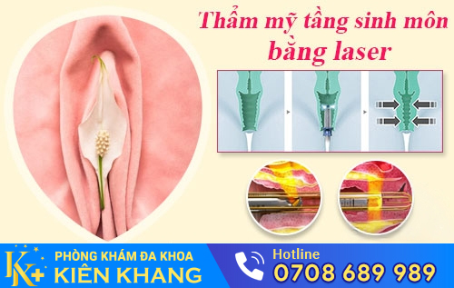 Thẩm mỹ tầng sinh môn bằng phương pháp Laser