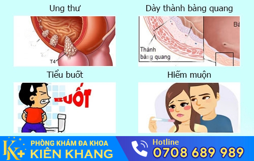 Tác hại của viêm bàng quang