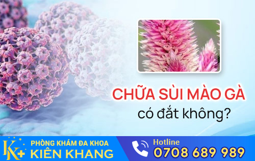 chua sui mao ga có dat khong