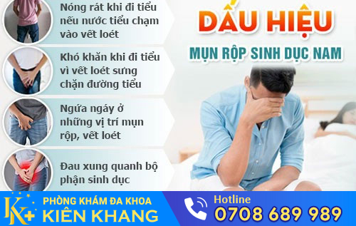 Biểu hiện mụn rộp sinh dục ở nam