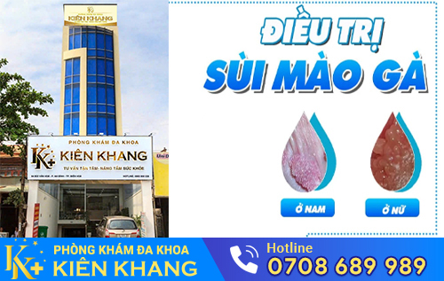 Phòng Khám Đa Khoa Kiên Khang - Địa chỉ chữa bệnh hoa khế uy tín