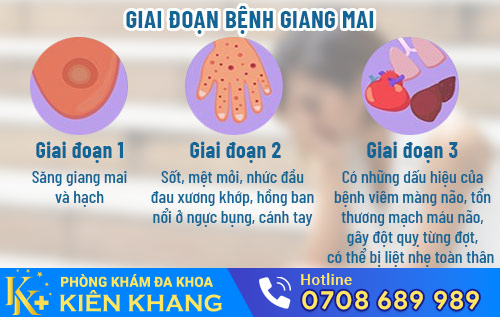 giai doan benh giang mai o nu