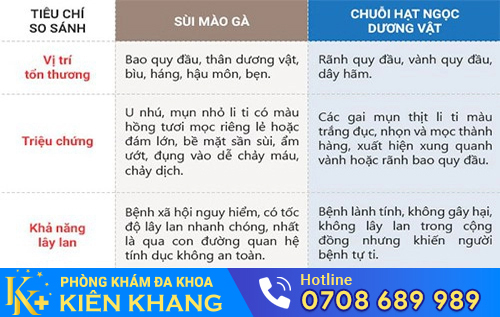 Phân biệt chuỗi hạt ngọc dương vật và sùi mào gà