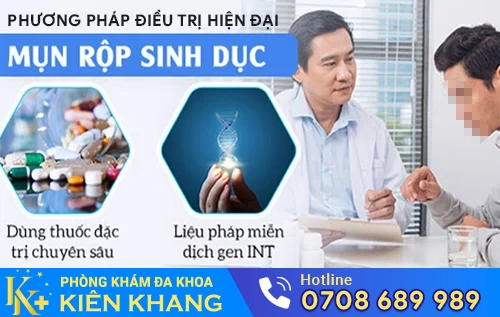 phuong phap dieu tri hien dai mun rop sinh duc