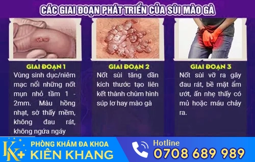 sui mao ga nam gioi