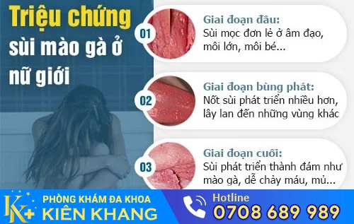 sui mao ga o nu gioi