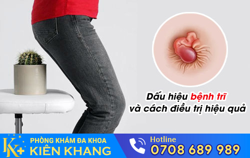 bệnh trĩ