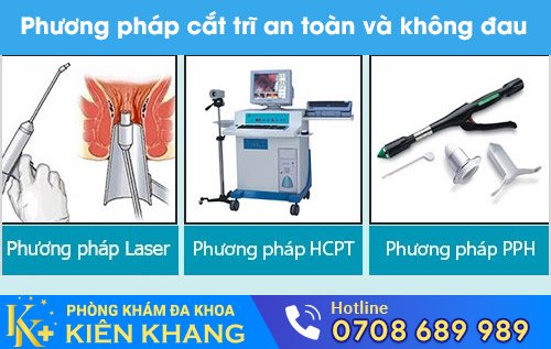Phương pháp cắt trĩ an toàn, không đau